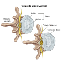 Ilustración de tipos diferentes de fracturas del cráneo