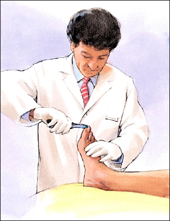 Cross section of peripheral artery with plaque buildup and blood clot.